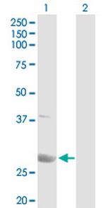 PSME1 Antibody in Western Blot (WB)