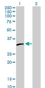 PSME2 Antibody in Western Blot (WB)