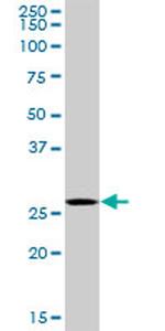 PSME2 Antibody in Western Blot (WB)