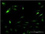 PSME2 Antibody in Immunocytochemistry (ICC/IF)