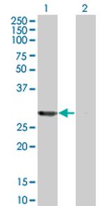 PSME2 Antibody in Western Blot (WB)