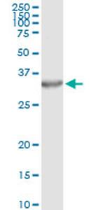 PSME2 Antibody in Immunoprecipitation (IP)