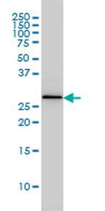 PSME2 Antibody in Western Blot (WB)