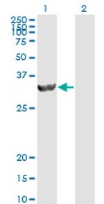 PSME2 Antibody in Western Blot (WB)