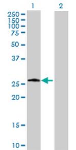 PSPH Antibody in Western Blot (WB)