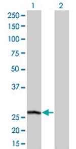 PSPH Antibody in Western Blot (WB)