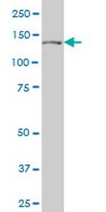 PTCH Antibody in Western Blot (WB)