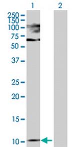 PTH Antibody in Western Blot (WB)