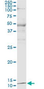 PTH Antibody in Immunoprecipitation (IP)