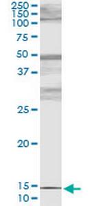 PTH Antibody in Immunoprecipitation (IP)