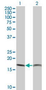 PTH Antibody in Western Blot (WB)