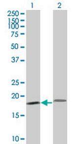 PTH Antibody in Western Blot (WB)