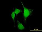 PTGS2 Antibody in Immunocytochemistry (ICC/IF)