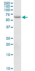 PTGS2 Antibody in Western Blot (WB)