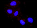 PTK2 Antibody in Proximity Ligation Assay (PLA) (PLA)