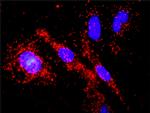 PTK2 Antibody in Proximity Ligation Assay (PLA) (PLA)