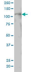 PTK2 Antibody in Western Blot (WB)