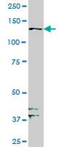 PTK7 Antibody in Western Blot (WB)