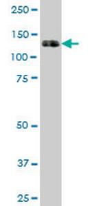 PTK7 Antibody in Western Blot (WB)