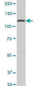 PTK7 Antibody in Western Blot (WB)