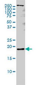 PTN Antibody in Western Blot (WB)