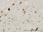 PTN Antibody in Immunohistochemistry (Paraffin) (IHC (P))