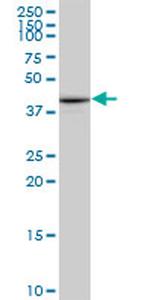 PTX3 Antibody in Western Blot (WB)