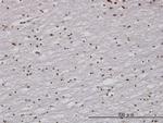 RAD1 Antibody in Immunohistochemistry (Paraffin) (IHC (P))