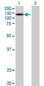 PWP2 Antibody in Western Blot (WB)