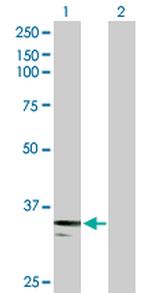 PXN Antibody in Western Blot (WB)