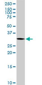 PYCR1 Antibody in Western Blot (WB)