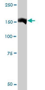 QARS Antibody in Western Blot (WB)