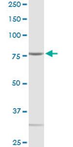 QARS Antibody in Western Blot (WB)