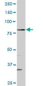 QARS Antibody in Western Blot (WB)