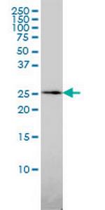 QDPR Antibody in Western Blot (WB)