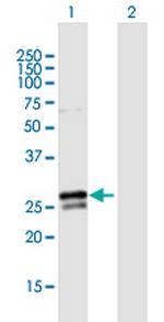 RAB3B Antibody in Western Blot (WB)