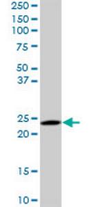 RAB6A Antibody in Western Blot (WB)