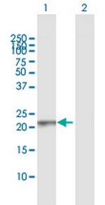 RAB13 Antibody in Western Blot (WB)