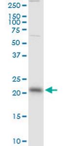 RAB13 Antibody in Western Blot (WB)