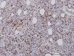 RAB27A Antibody in Immunohistochemistry (Paraffin) (IHC (P))