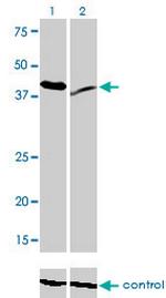 RAD23A Antibody in Western Blot (WB)