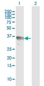 RAD51 Antibody in Western Blot (WB)