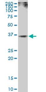 RAD51 Antibody in Western Blot (WB)