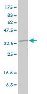 RAD51 Antibody in Western Blot (WB)