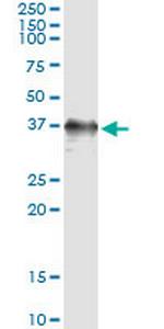 RAD51 Antibody in Immunoprecipitation (IP)