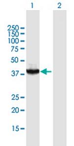 RAD51C Antibody in Western Blot (WB)