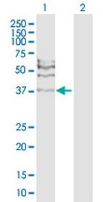 RAD51C Antibody in Western Blot (WB)