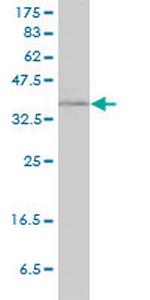 RAD51C Antibody in Western Blot (WB)