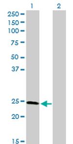 RAD51L3 Antibody in Western Blot (WB)