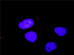 RAF1 Antibody in Proximity Ligation Assay (PLA) (PLA)